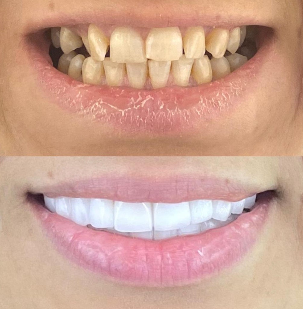 Consultation setting used when planning a coordinated dental journey in Istanbul