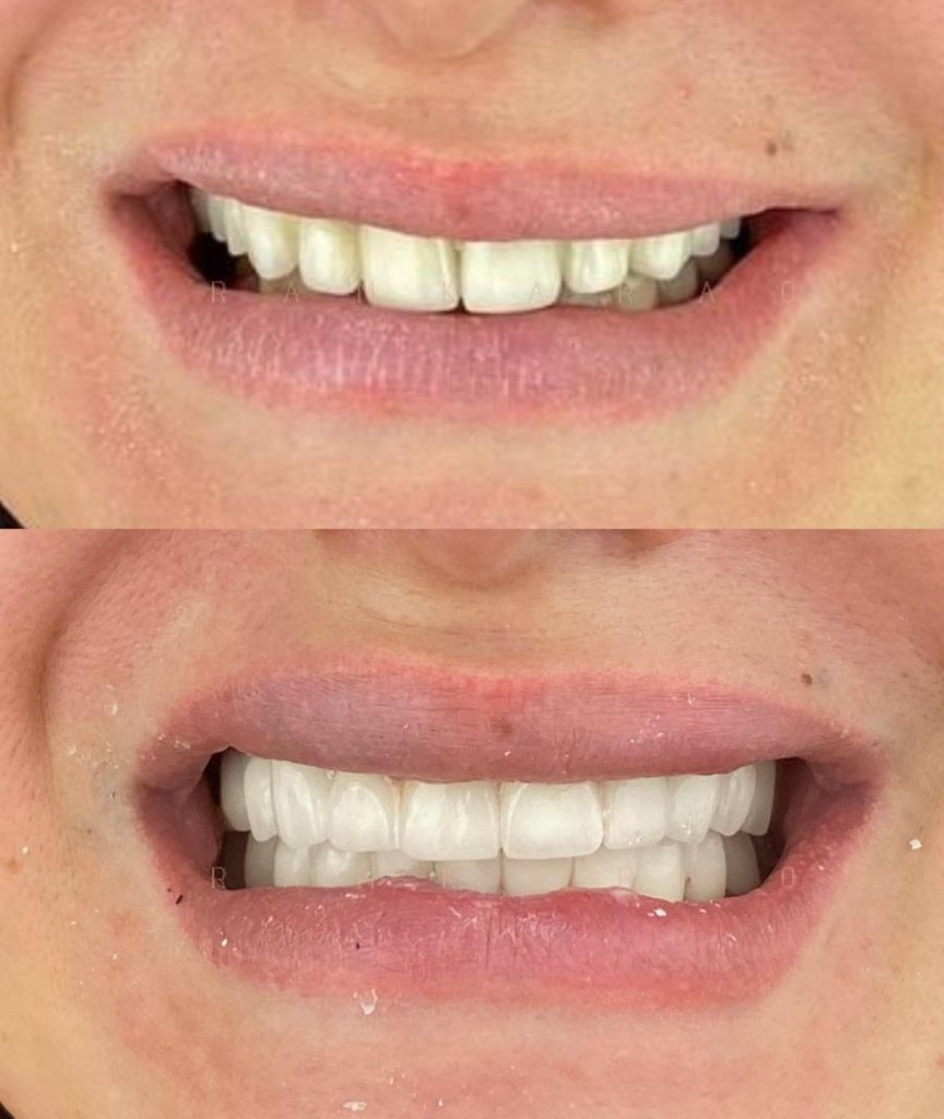 Smile planning